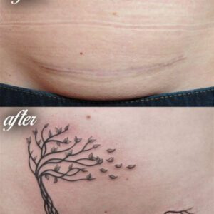 Tattoo Ideas for C Section Scar Tattoo Ideas for C Section Scar
