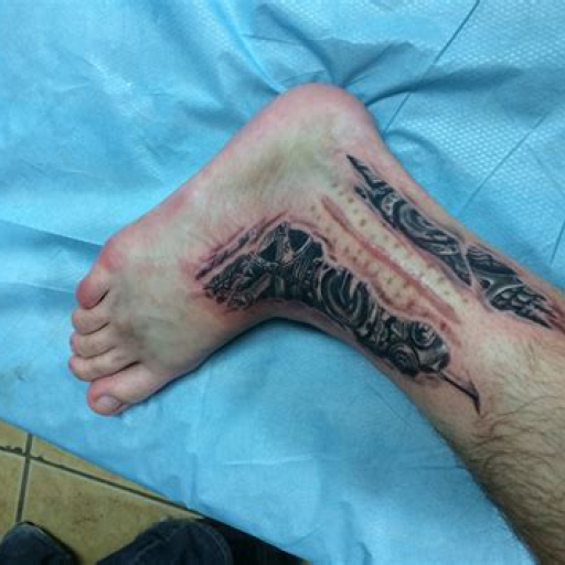 Ankle Surgery Ankle Scar Tattoo Ideas Ankle Surgery Ankle Scar Tattoo Ideas