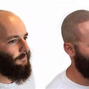 Is Hair Tattoo a Good Idea? Is Hair Tattoo a Good Idea?